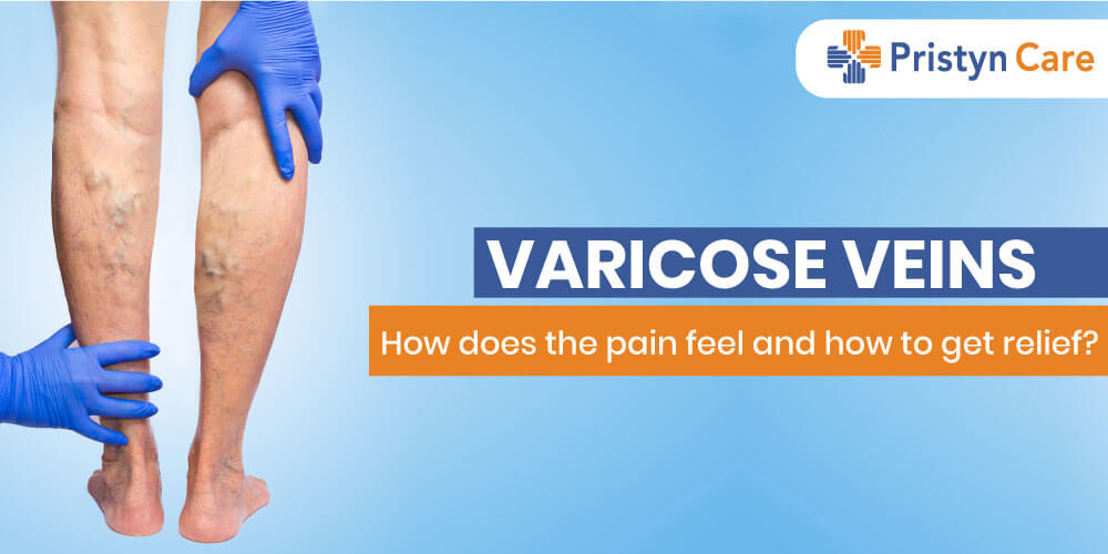 Varicose Veins How does the pain feel and how to get relief? Pristyn