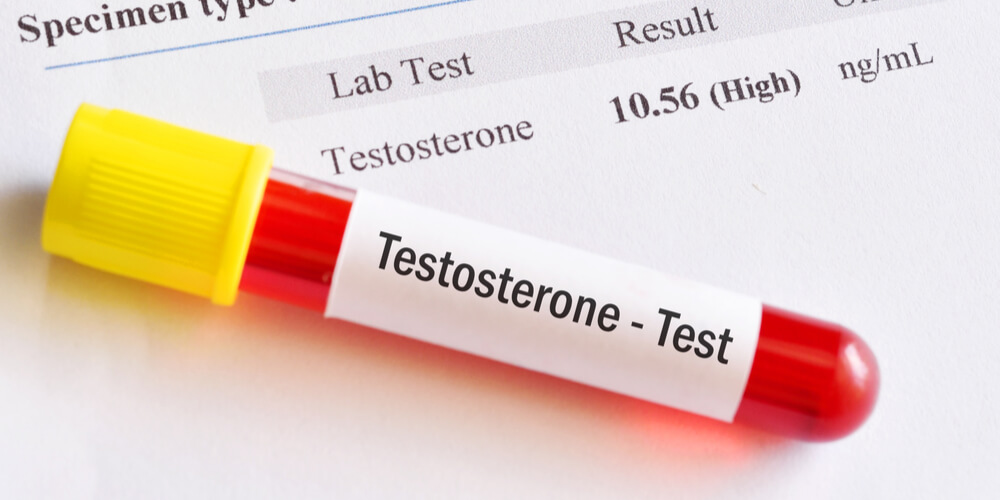 High Testosterone levels