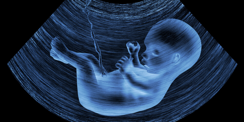 ultrasound of a baby