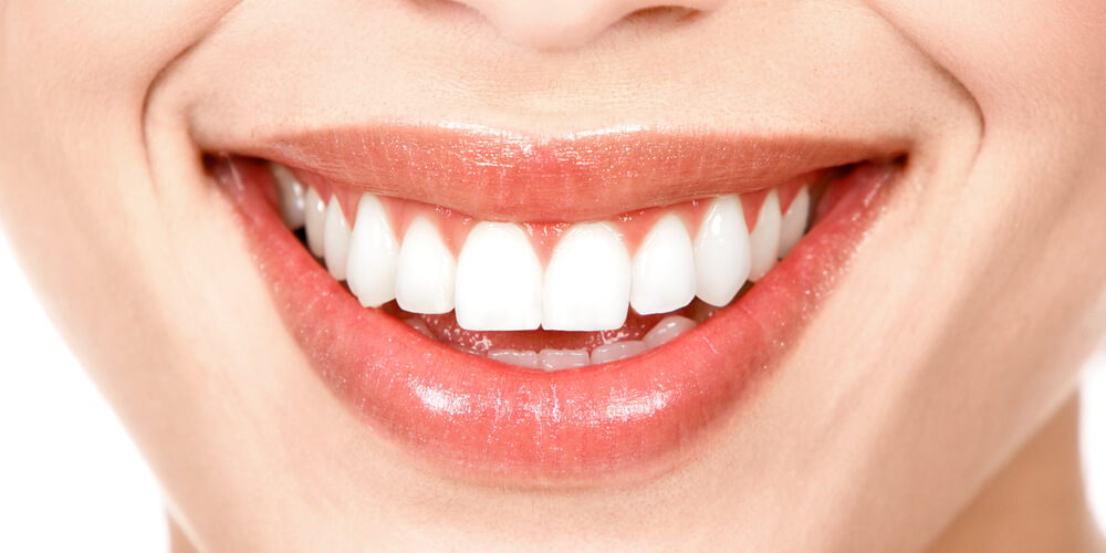 Woman with good oral hygiene