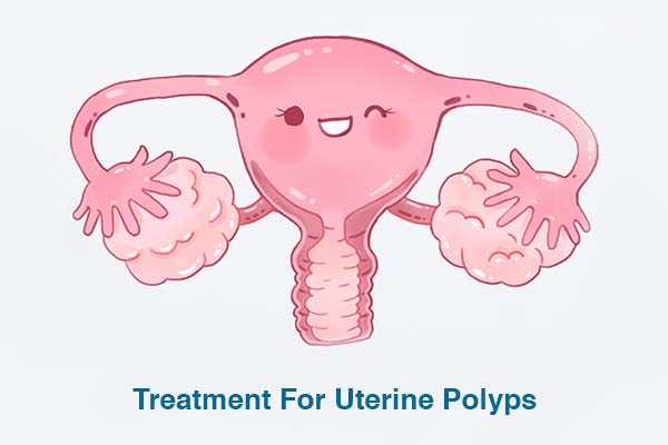Uterine Polyps Cancer
