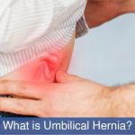 what is umbilical hernia