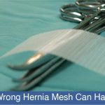 wrong mesh can be harmful