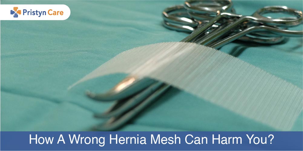 wrong mesh can be harmful