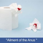 Ailment of Anus