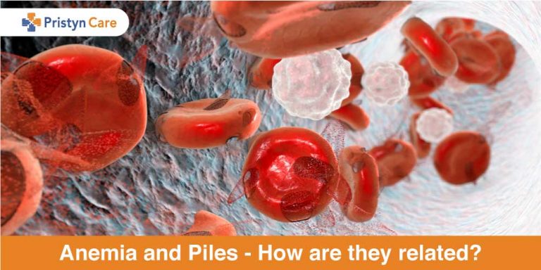 Anemia and piles - how are they related