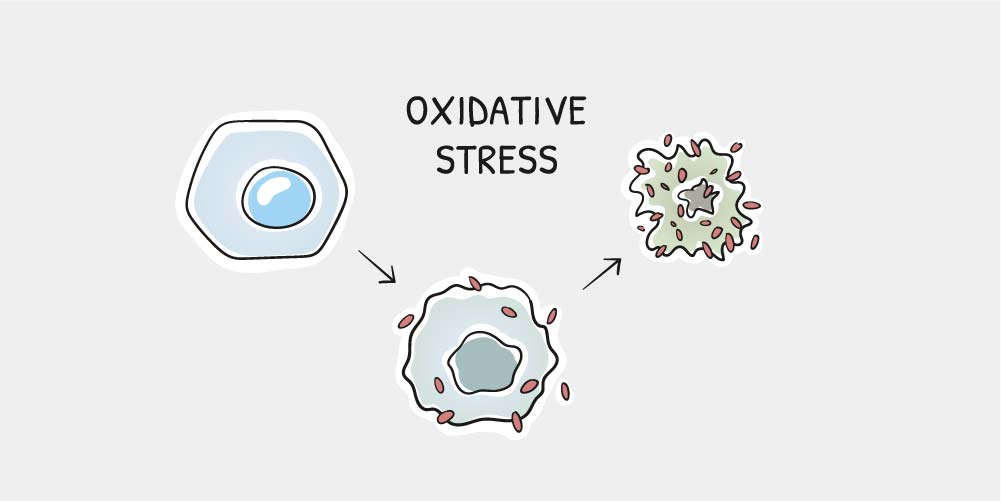 Oxidative Stress
