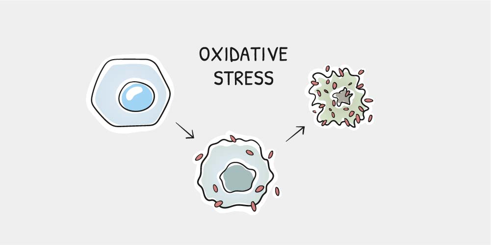 Oxidative Stress