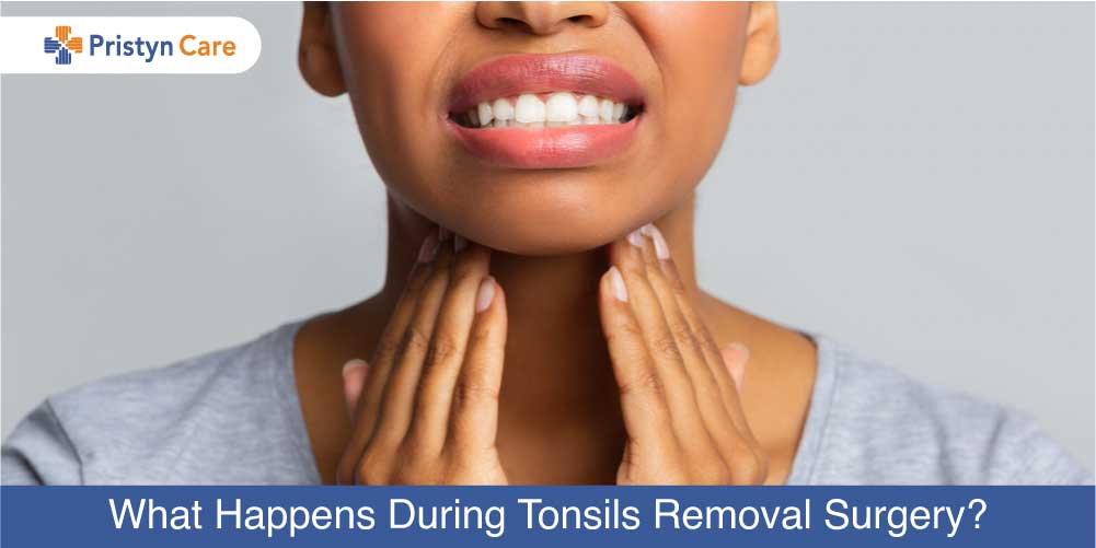 Tonsil Removal Before And After