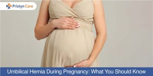 Cover image for hernia during pregnancy