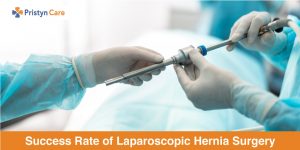Cover image for success rate of laparoscopy