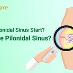 How does pilonidal sinus start