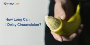 How long can I delay circumcision