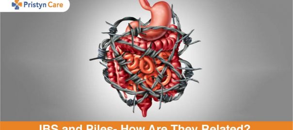 IBS and Piles – How are They Related? 