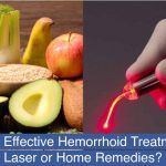 Most effective piles treatment laser or home remedy