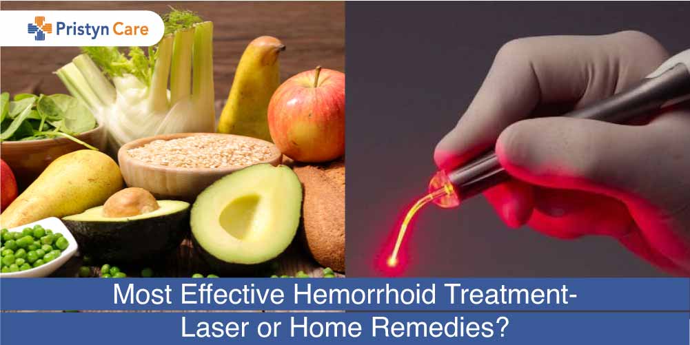 Most effective piles treatment laser or home remedy