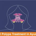 Nasal Polyps Treatment in Ayurveda