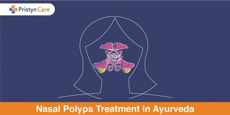 Nasal Polyps Treatment in Ayurveda