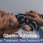 Obstetric Fistula