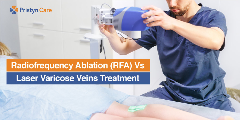 Radiofrequency Ablation (RFA) Vs Laser Varicose Veins Treatment Pristyn Care