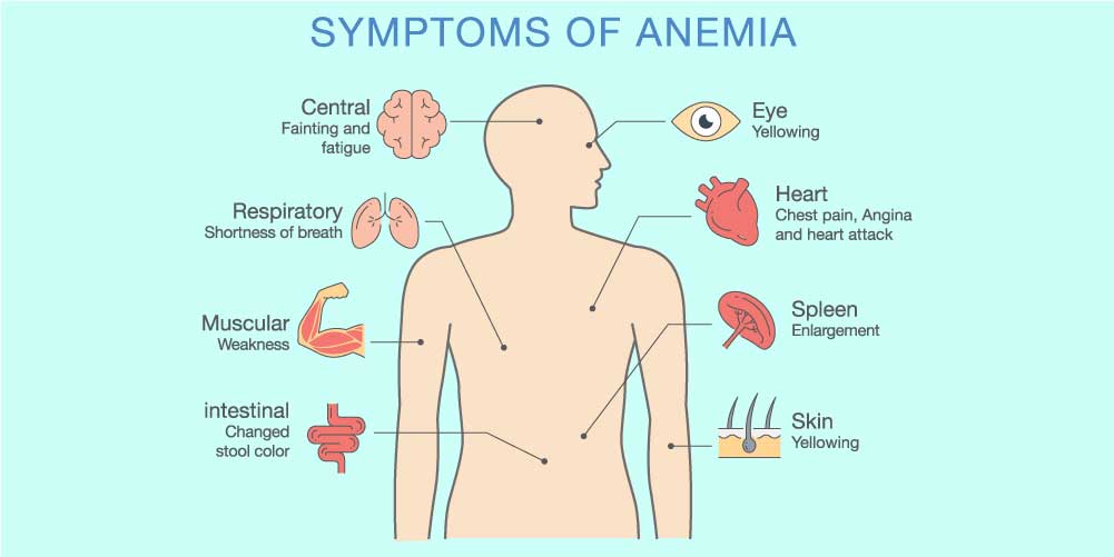 Symptoms of Anemia