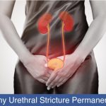 Urethral Stricture permanent solution