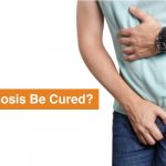 can phimosis be cured