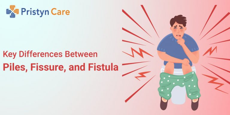 difference between piles, fissure and fistula