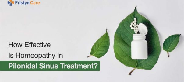 How Effective Is Homeopathy In Pilonidal Cyst Treatment?