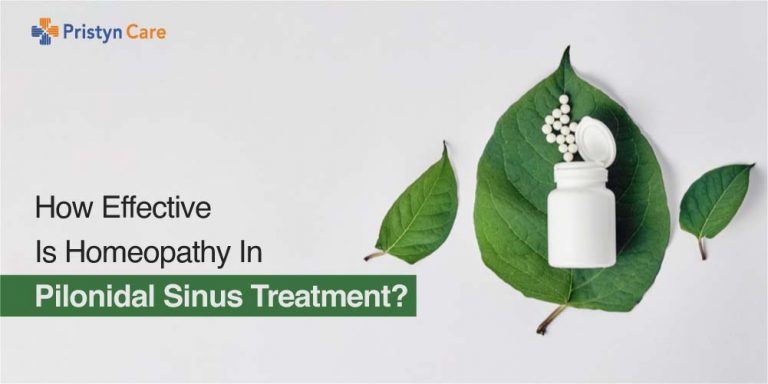 homeopathy for pilonidal sinus treatment