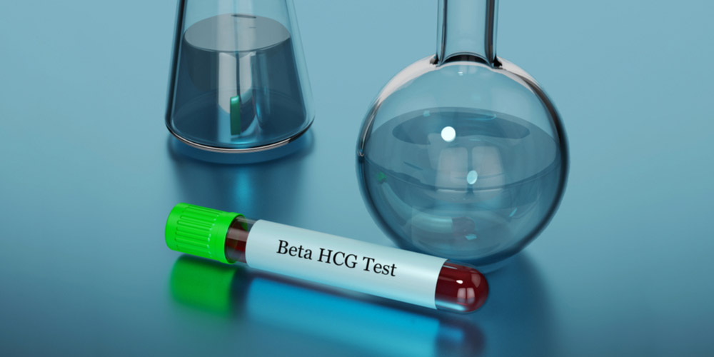 Pregnancy Blood Test