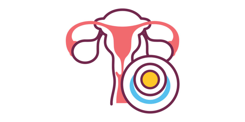 contraceptive sponge 