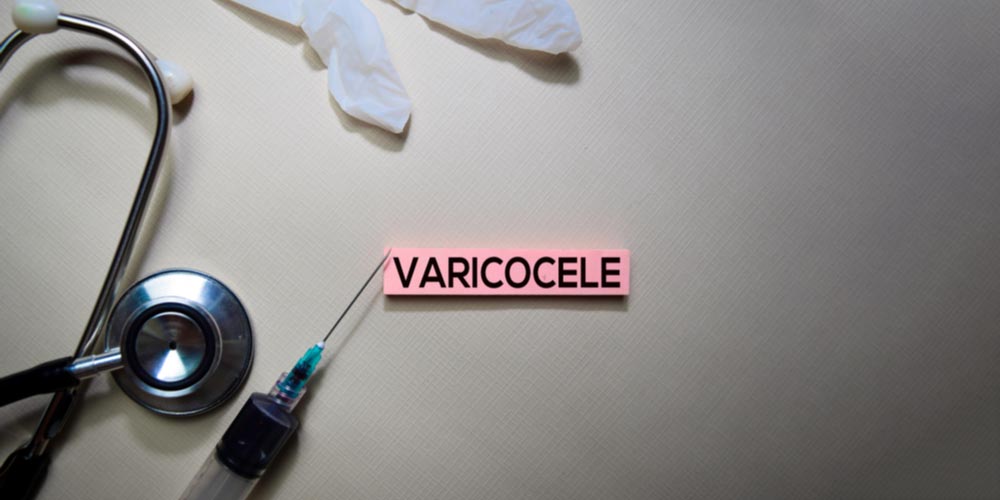 surgery for varicocele