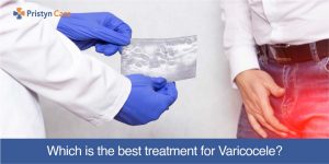 the best treatment for varicocele