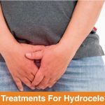 treatments for hydrocele