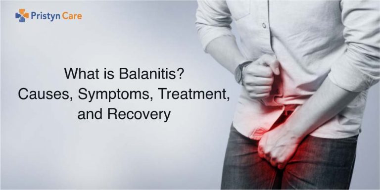 Home Remedies For Balanitis - Pristyn Care