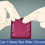 sex after circumcision