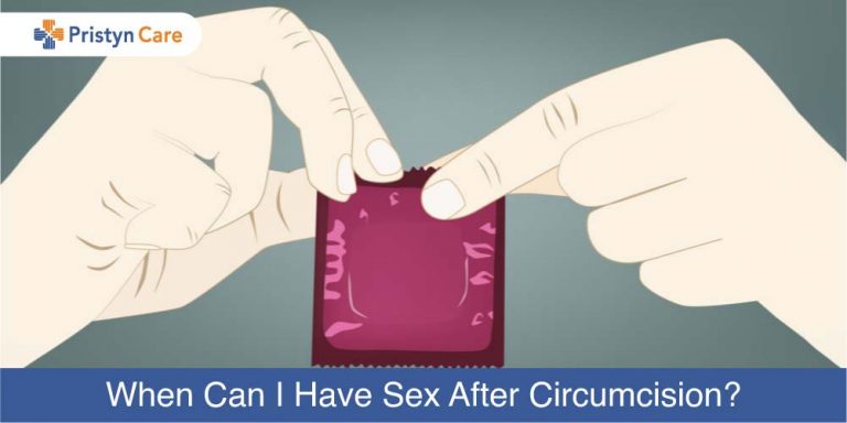 sex after circumcision