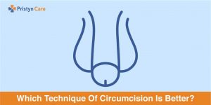 which technique of circumcision is better