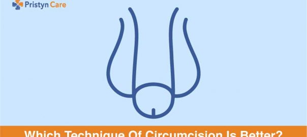 Which Circumcision Technique Is Better?