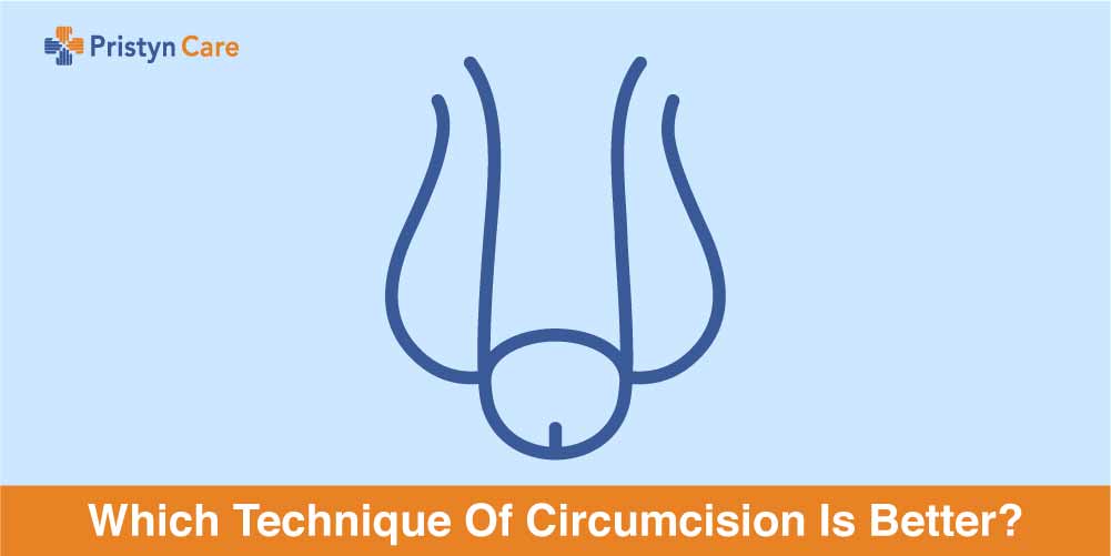 Evidence and Ethics on: Circumcision - Evidence Based Birth®