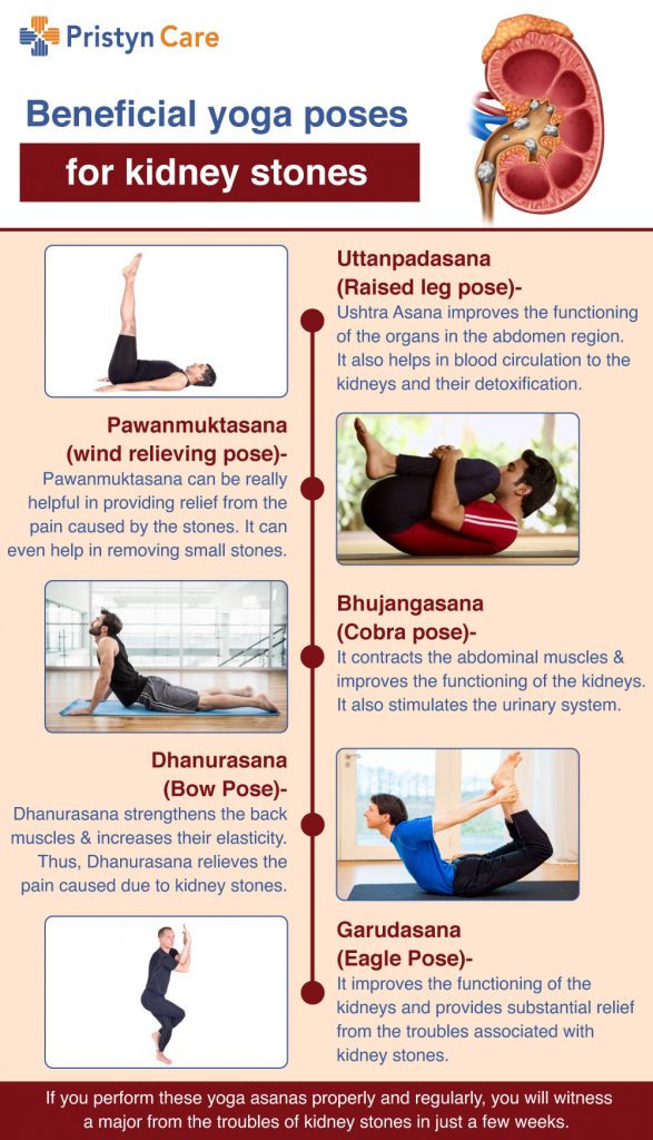 Beneficial-yoga-poses-for-kidney-stones