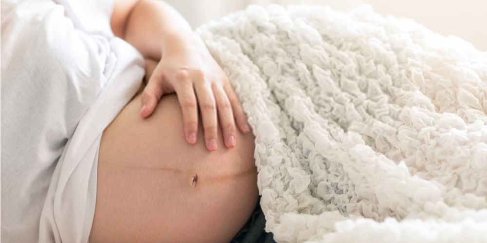 9 month pregnant female lying down