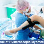 Outlook of Hysteroscopic Myomectomy