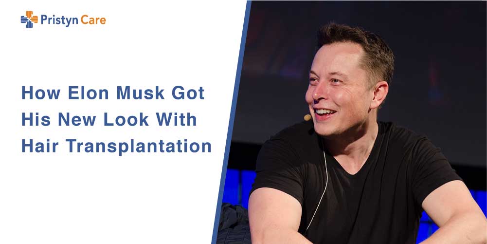 How Elon Musk Got His New Look With Hair Transplantation - Pristyn Care