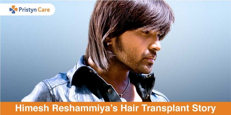 Himesh Reshammiya’s Hair Transplantion