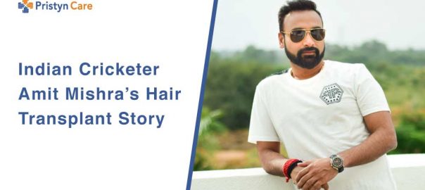 Indian Cricketer Amit Mishra’s Hair Transplant Story