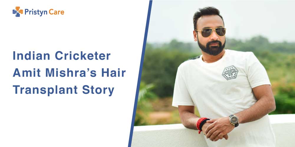 New look of Amit Mishra after Hair Transplantation