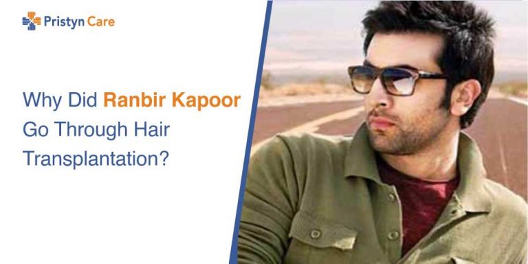 Ranbir Kapoor hair transplantation