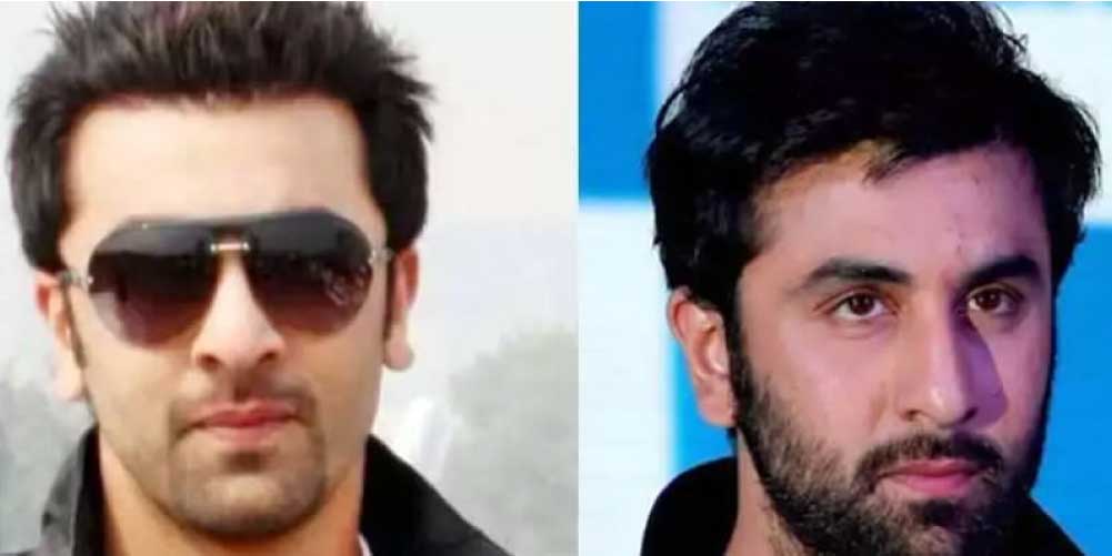 Ranbir Kapoor before & after hair transplant